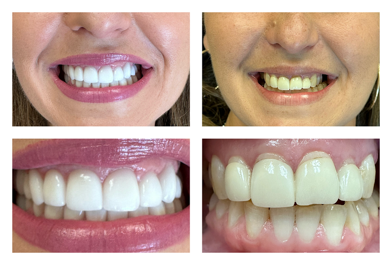 Cosmetic Treatment results